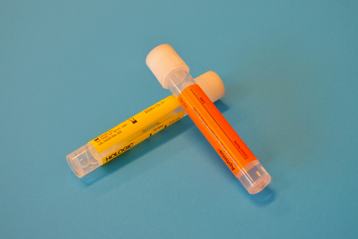 Nachweisbarkeit von 1BP-LSD